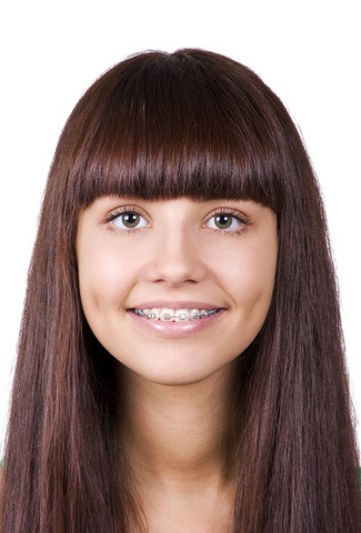 How long does orthodontic treatment take?