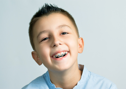 The Importance of Orthodontic Treatment at a Young Age